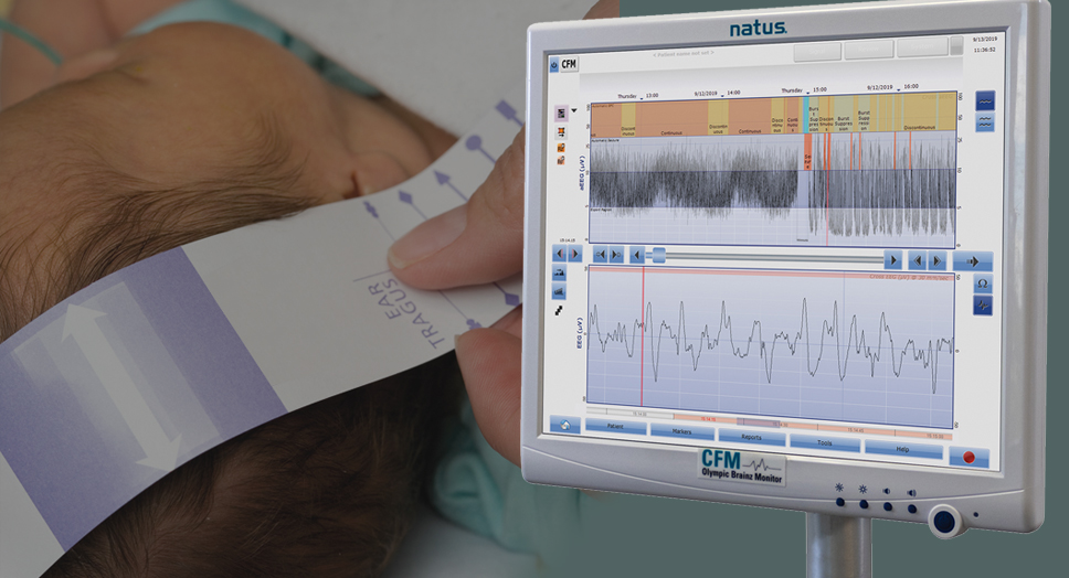aEEG Olympic Brainz Monitor (OBM) On Demand Training (USA